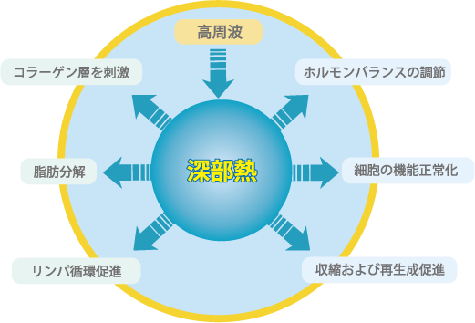 ラジオ波のイメージ2